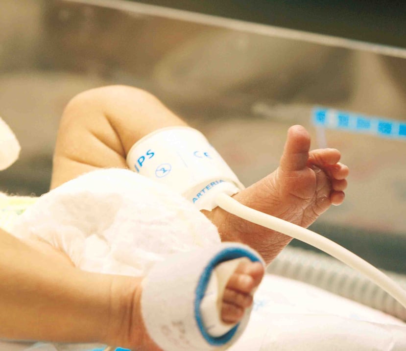 Los bebés prematuros y aquellos con ciertas complicaciones médicas son más susceptibles a complicarse tras el contagio de este virus.