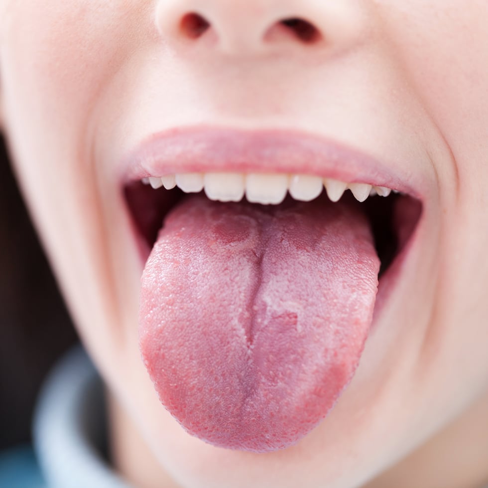 La lengua es un órgano que puede comunicar muchos aspectos de la salud.