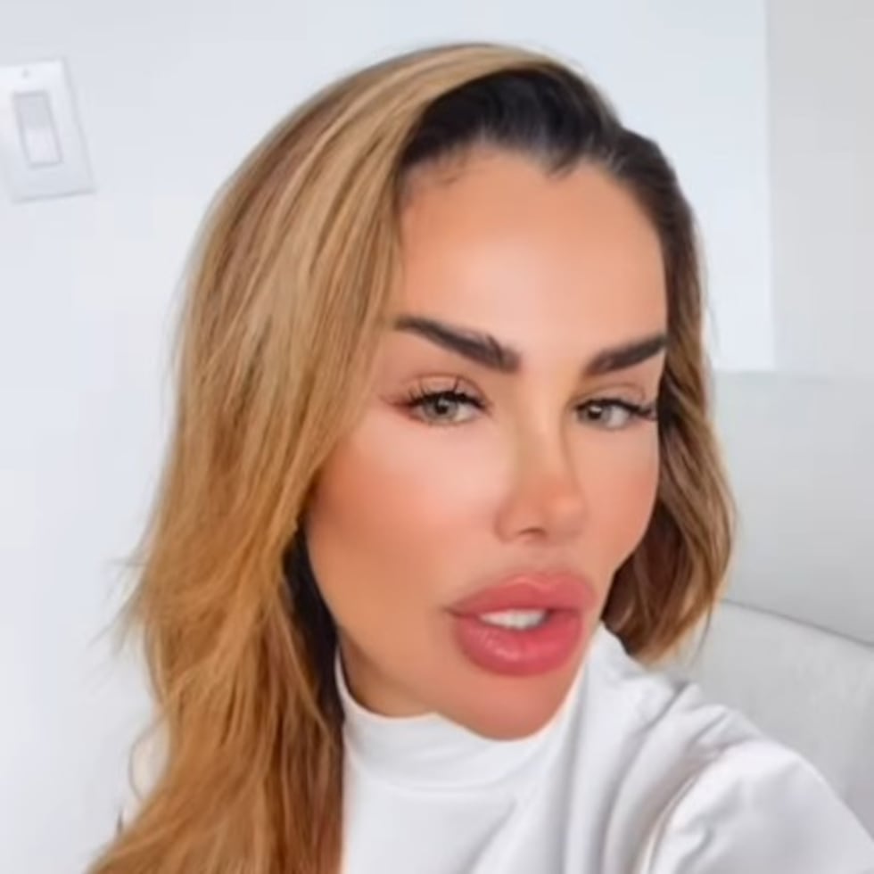 Ninel Conde muestra su nuevo color de ojos a través de la queratopigmentación.