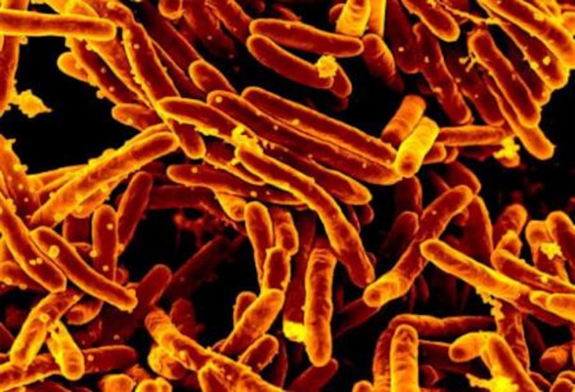 Bacteria que causa la tuberculosis (Flickr/NIH)