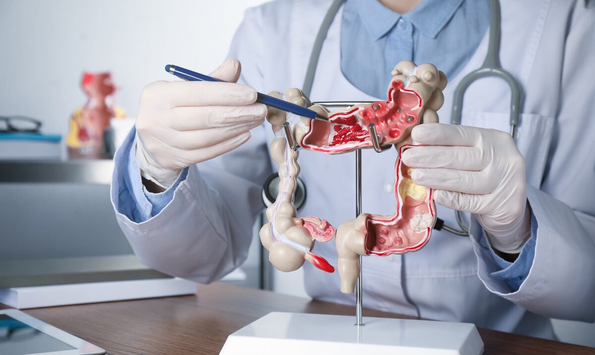 ¿Un síntoma común que puedes estar ignorando? La historia de un hombre que descubrió que tenía cáncer de colon en etapa 4