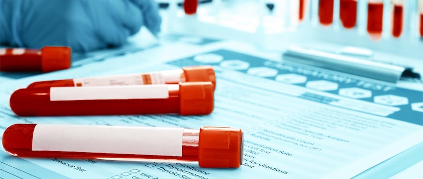 Es importante que las personas se hagan las pruebas para detectar el virus de hepatitis C, especialmente si tiene entre 50 a 75 años y si recibió una trasfusión de sangre antes de 1992. (Shutterstock)