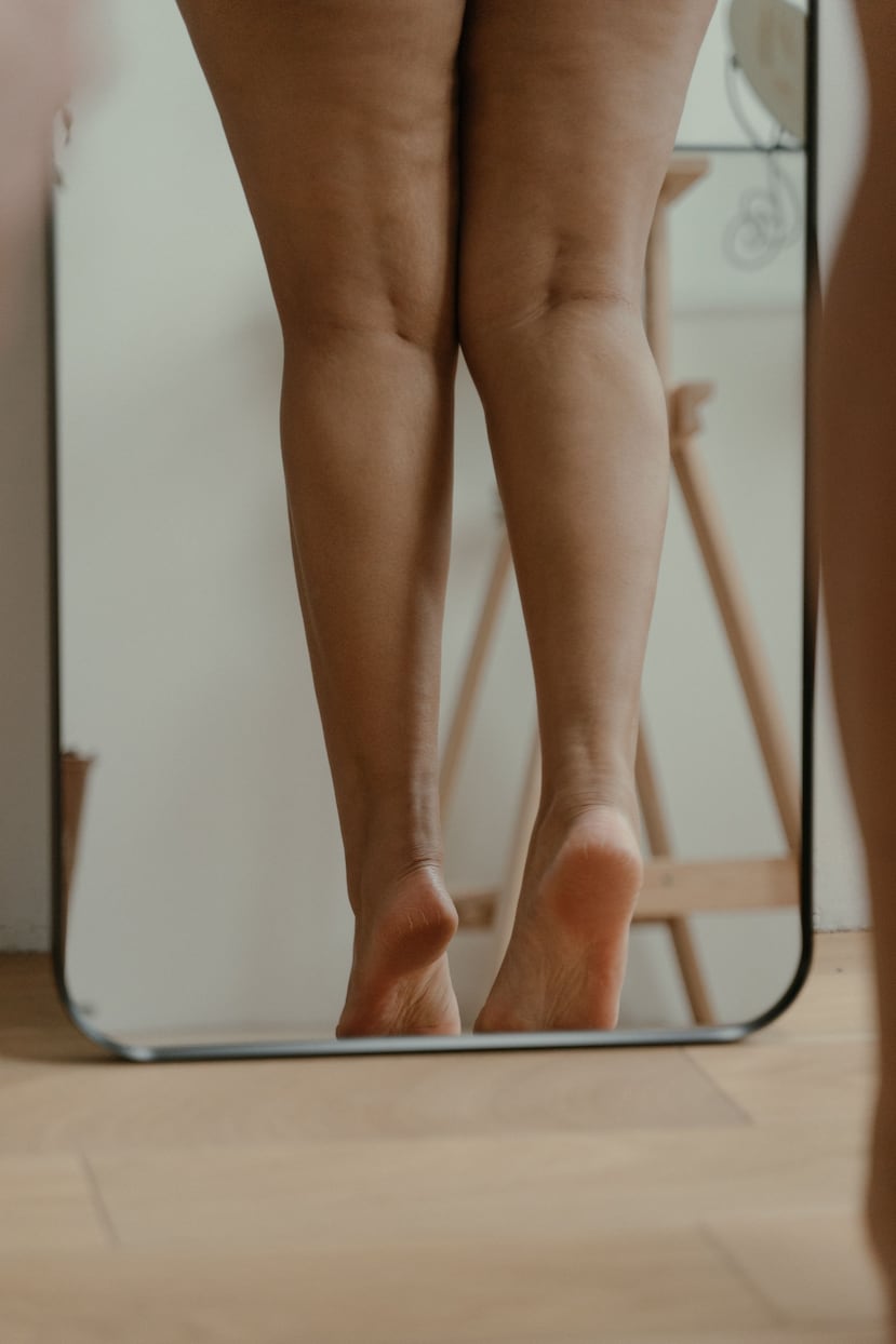 La celulitis afecta a entre el 80 % y el 90 % de las mujeres tras la pubertad. Foto cedida por Wellness Treat