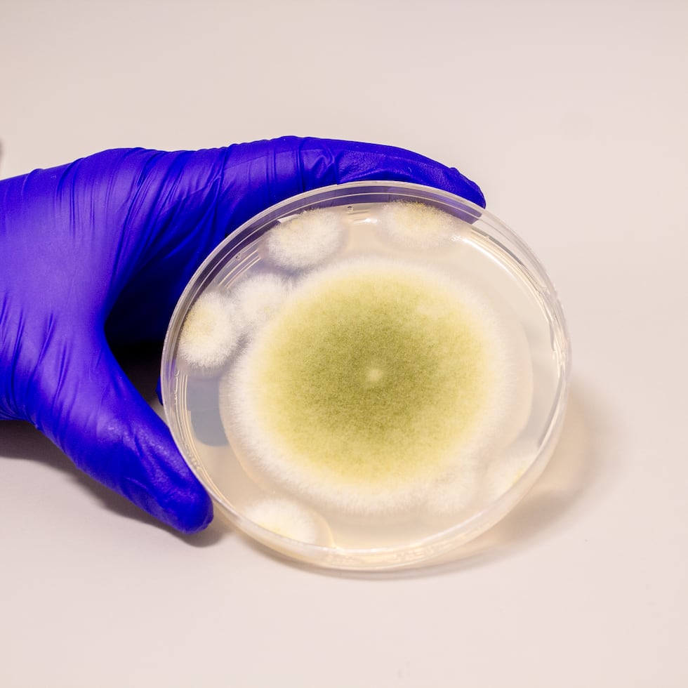 El estudio recién publicado identificó varios hongos ambientales, incluyendo “Aspergillus”, en la flora vaginal de 86 mujeres puertorriqueñas.