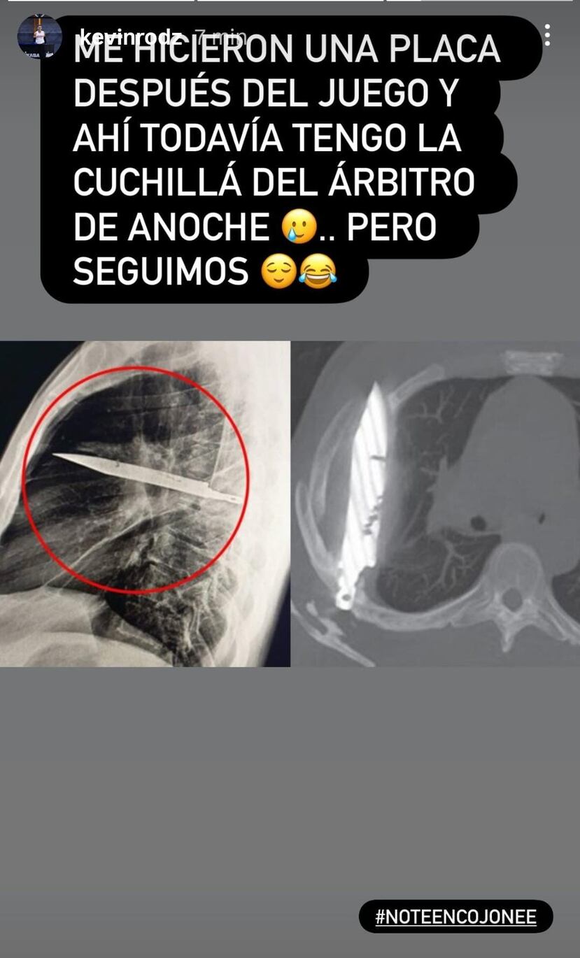 Esta fue la imagen acompañada de las expresiones de Kevin Rodríguez.