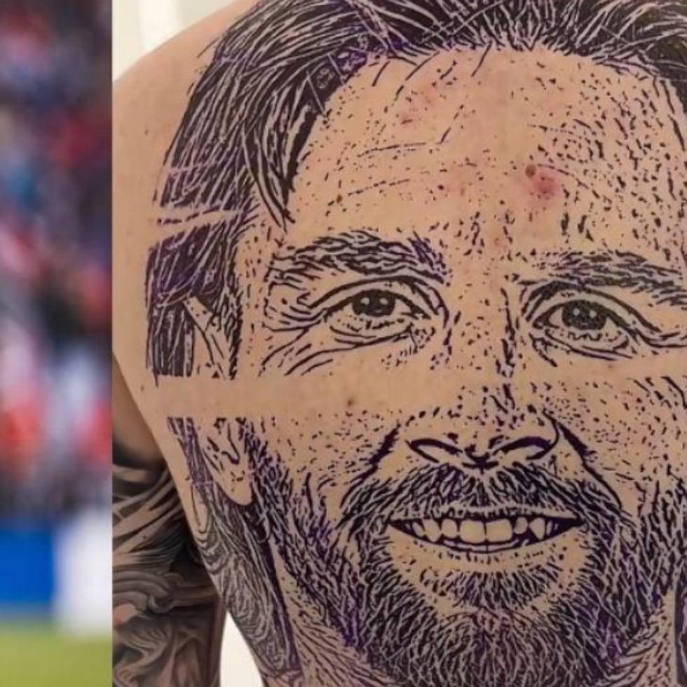 El tatuaje no tuvo el resultado esperado.