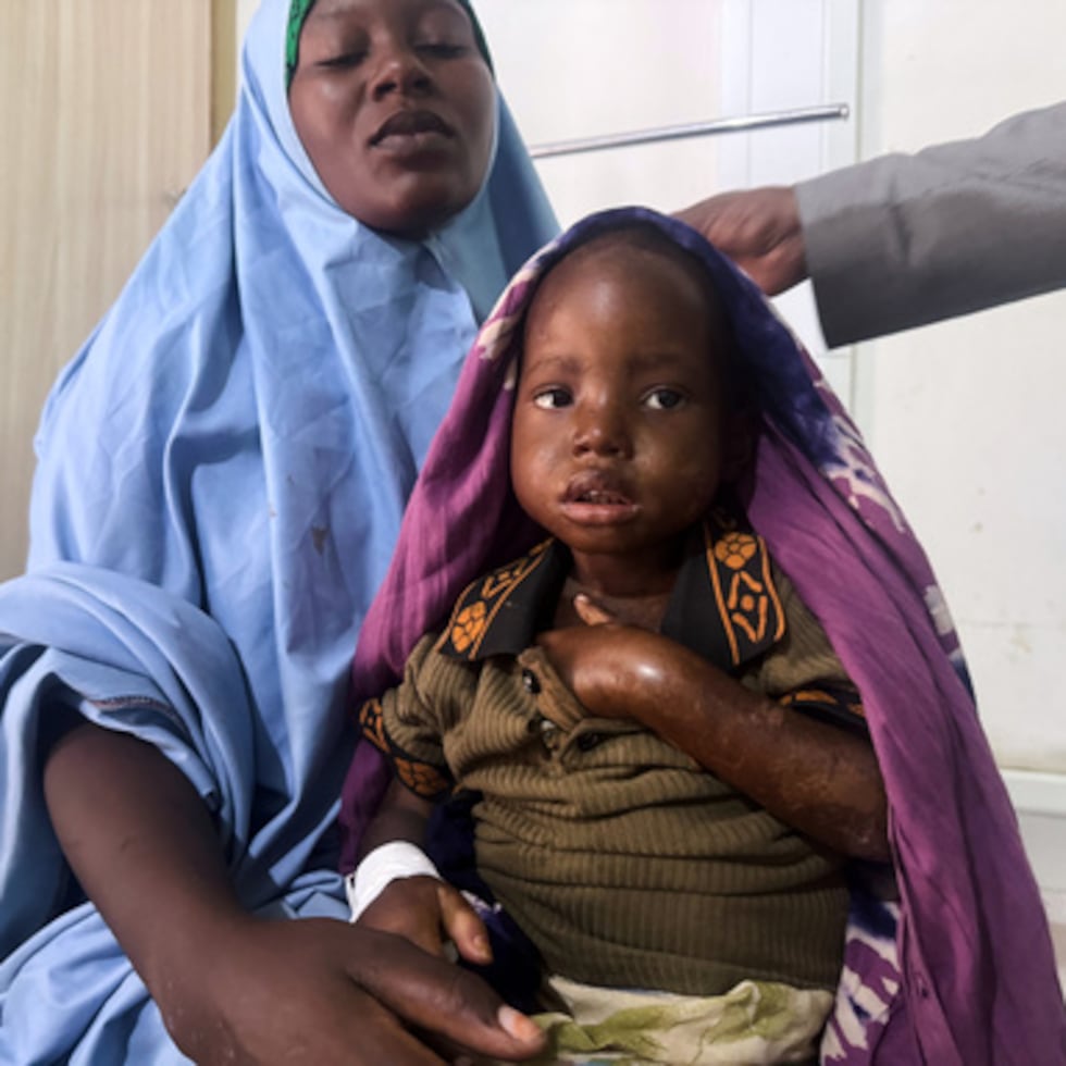 Halima Abdullahi Ibrahim sostiene en brazos a su hija Asho Hassan Abdi, de 3 años, en un centro de estabilización de Kismayo.