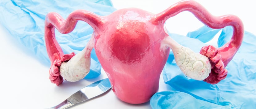 Las mujeres están cada vez más conscientes de que la extirpación de los ovarios plantea riesgos para la salud, el estudio plantea que la histerectomía por sí misma conlleva riesgos. (Shuttesrtock)