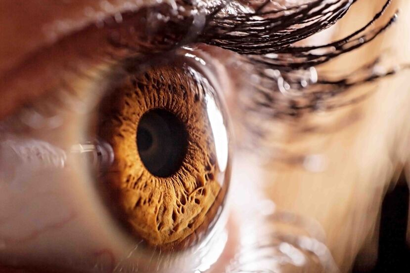 Alrededor del 3 %, de los pacientes con coronavirus presentan síntomas de conjuntivitis. (Shutterstock)
