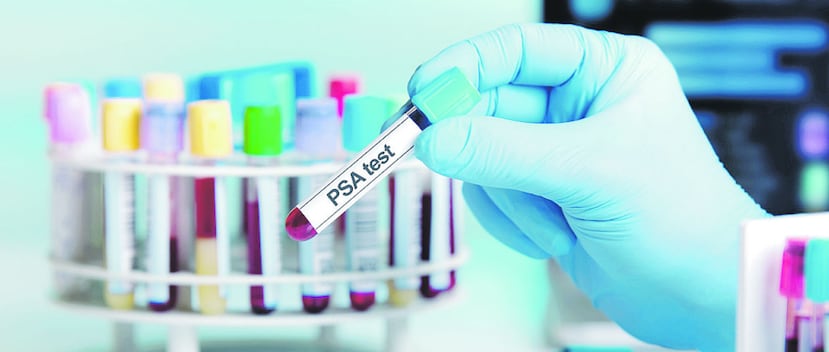 La importancia de la detección temprana del cáncer de próstata