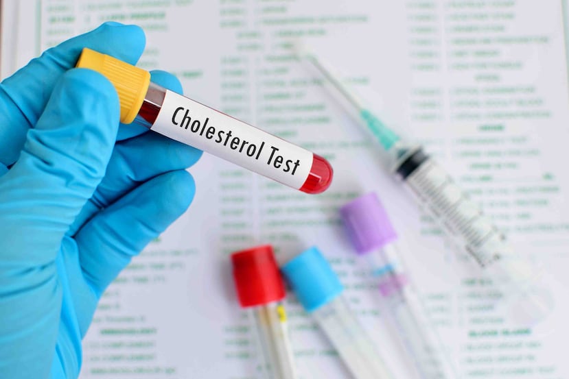 El HDL debería ser visto en realidad como una tercer prioridad, por detrás del LDL en primer lugar y los triglicéridos en segundo. (Foto: Shutterstock.com)