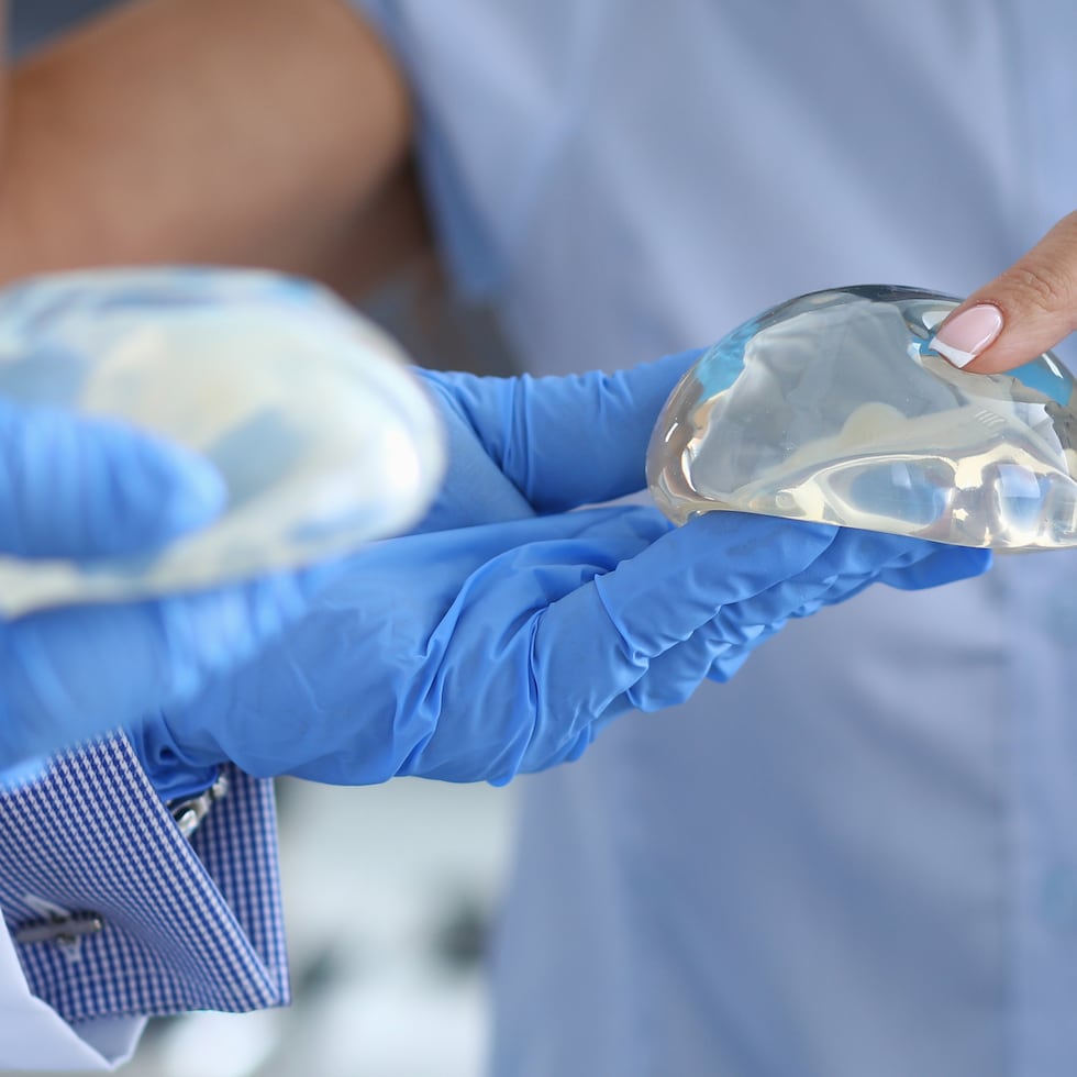 Los implantes de seno, independientemente de que en su interior sea de silicona o agua salina estéril, cabe destacar que su cubierta exterior e interior es de silicona.