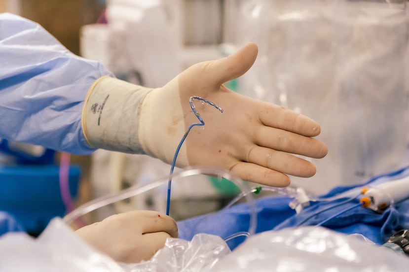 La energía eléctrica se transmite a través de los electrodos que están en la punta del catéter.