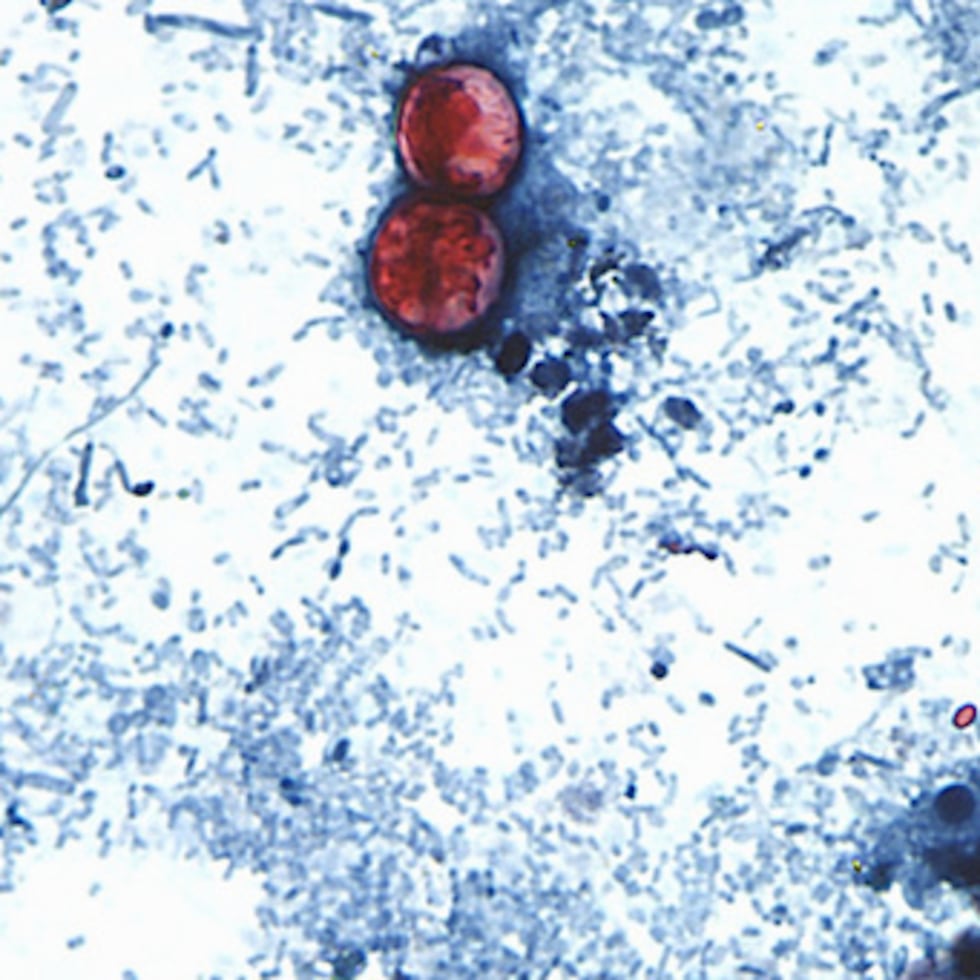 Esta fotografía sin fecha, tomada a través de un microscopio cedido por los CDC, muestra oocistos de Cyclospora cayetanensis encontrados en una muestra de heces frescas que había sido preparada con una solución de formalina y teñida con safranina.
