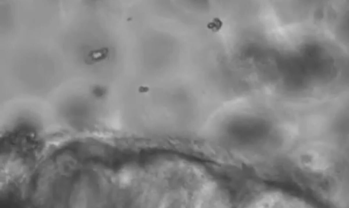 Investigadores boricuas capturan imagen microscópica del polvo del Sahara en vías respiratorias