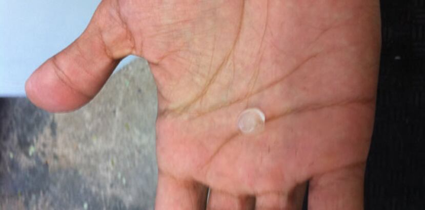 El granizo medía .25 pulgadas, según reportó la oficina de Manejo de Emergencia de Utuado. (Archivo)