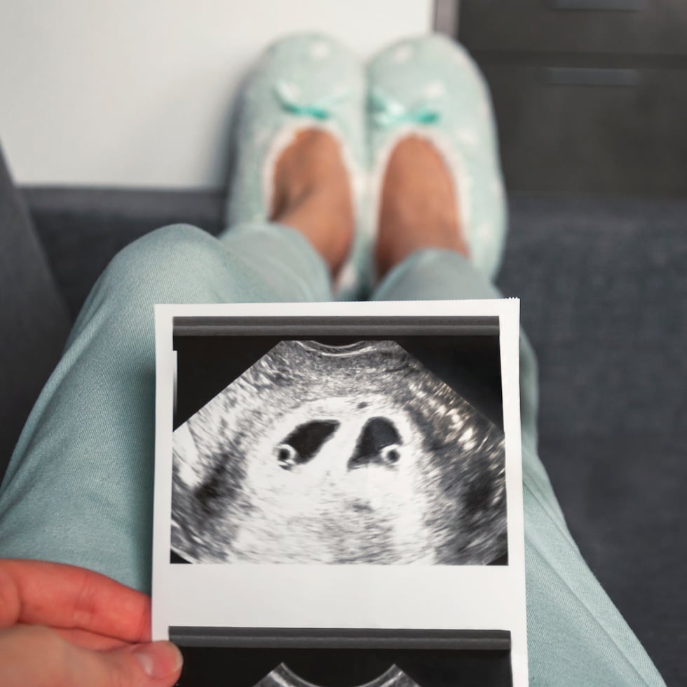 Una imagen de un embarazo gemelar.