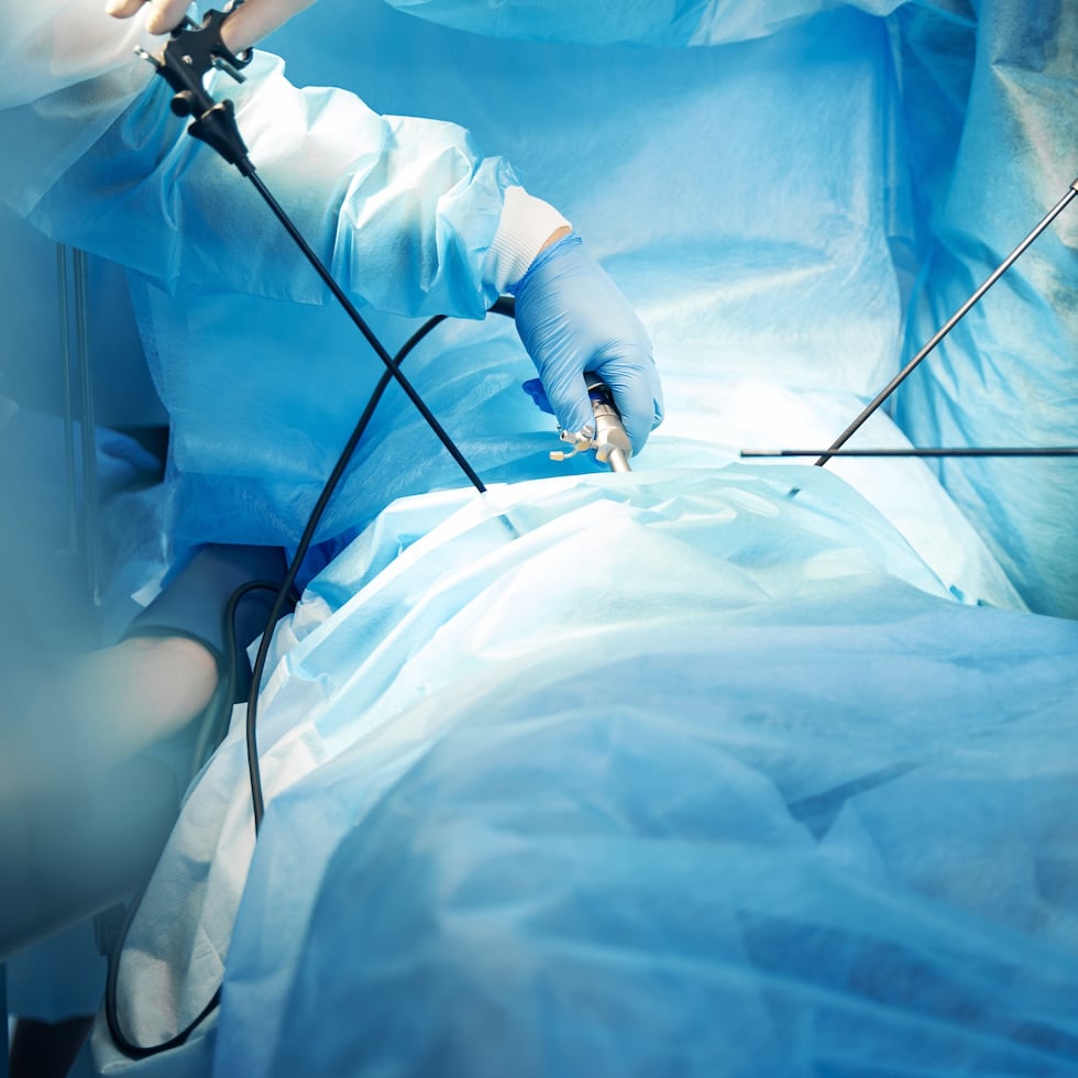 En una laparoscopia el médico inserta una cámara iluminada a través de pequeñas incisiones para examinar u operar los órganos del abdomen o la pelvis.