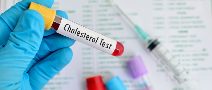 La discrepancia entre los exámenes de colesterol y los tratamientos médicos ha sido más pronunciada en pacientes jóvenes. (Shutterstock)