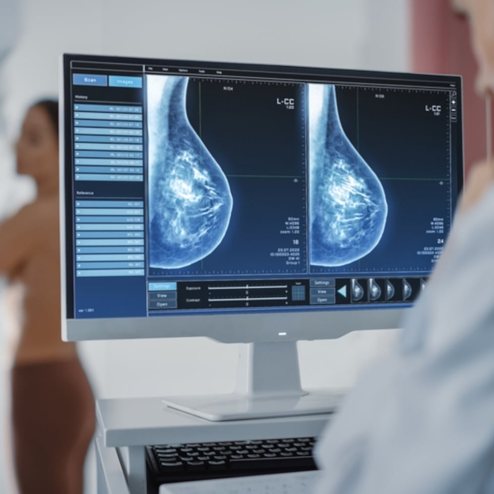 La investigación buscará impulsar a las mujeres a hacerse la mamografía mediante tres esfuerzos educativos.