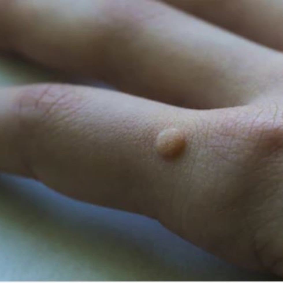 El proyecto obligaría a todo centro de servicios estéticos o sueroterapia a contar con una licencia de operación emitida por el Departamento de Salud, a renovarse cada dos años.