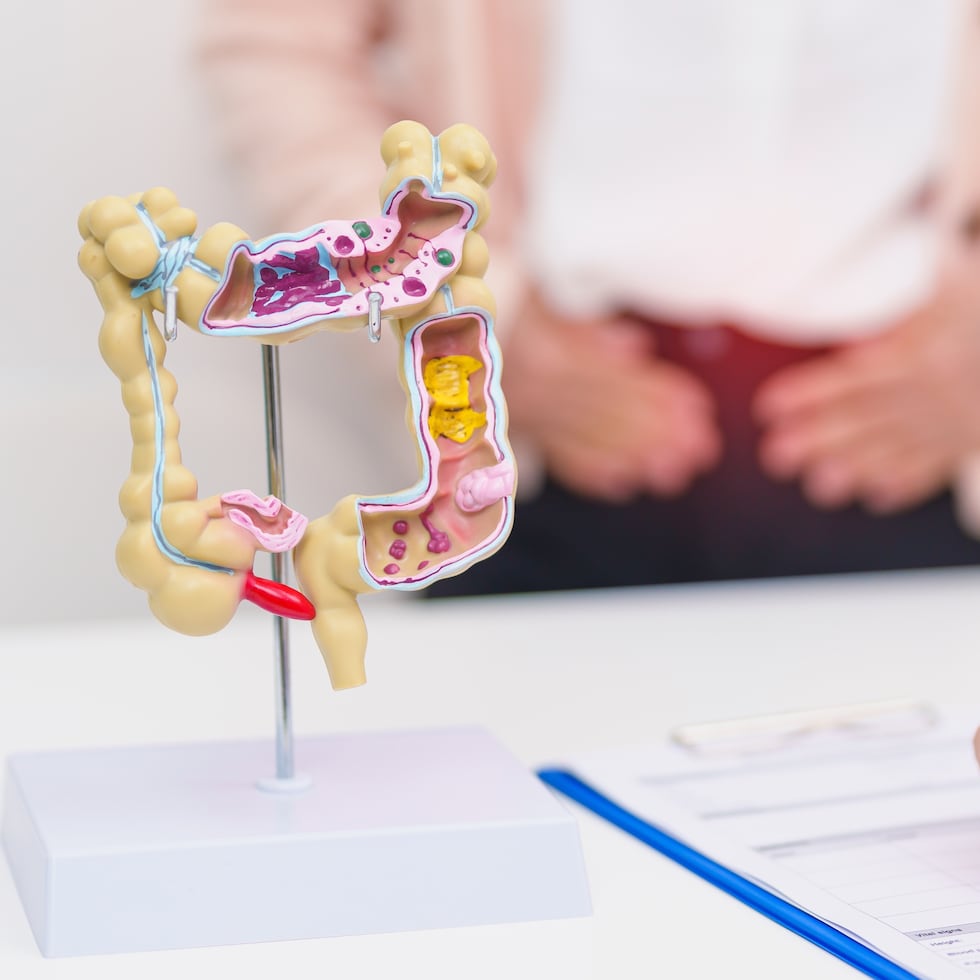 A pesar de que las enfermedades inflamatorias del intestino pueden impactar a personas de todas las edades, se observan, principalmente, entre adolescentes y adultos jóvenes.