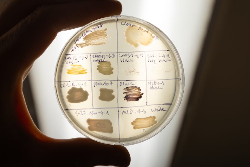 Una placa de Petri con diferentes microorganismos aislados por los investigadores. (Foto por Frank Xavier Ferrer González)