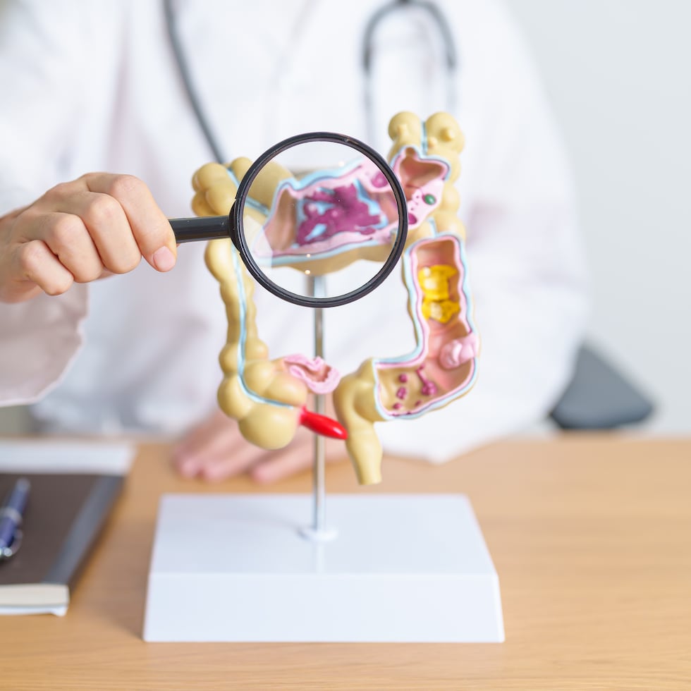 En Puerto Rico se están estudiando posibles factores biológicos, ambientales y de estilo de vida que podrían estar influyendo en el aumento de casos de cáncer colorrectal, especialmente en adultos jóvenes.