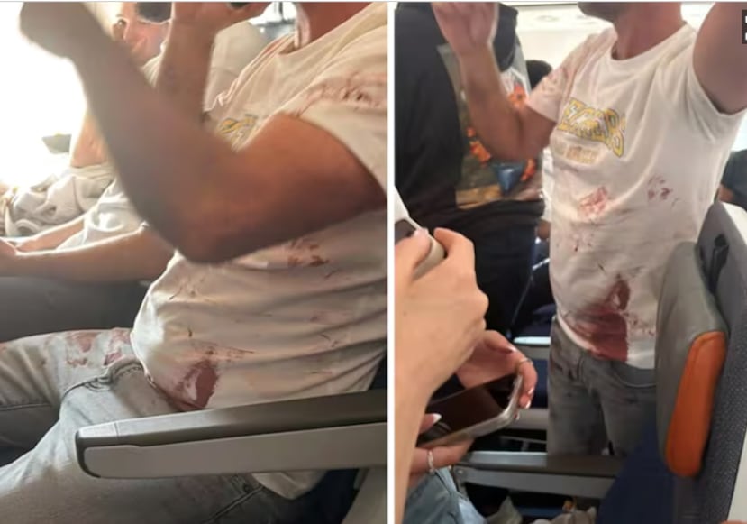 El incidente comenzó cuando uno de los pilotos apuñaló al otro y, al parecer, intentó estrellar el avión.