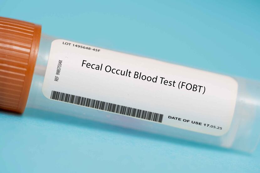 La prueba de sangre oculta detecta la presencia de hemoglobina (sangre) oculta en la excreta.