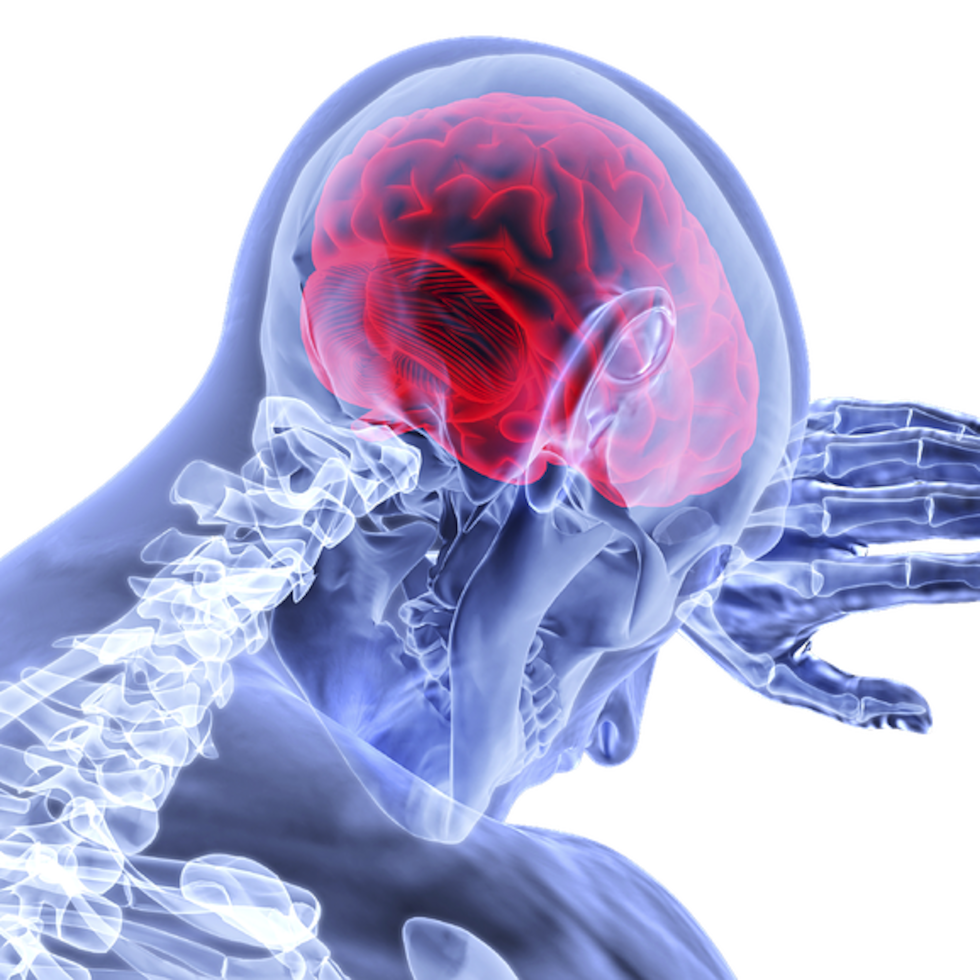 La esclerosis múltiple (EM) es una enfermedad del sistema nervioso que afecta al cerebro y la médula espinal.
