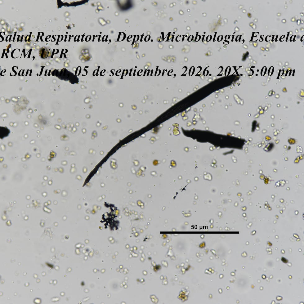 Fotografías tomadas mediante un microscopio mostraron partículas negras de distintos tamaños y formas.