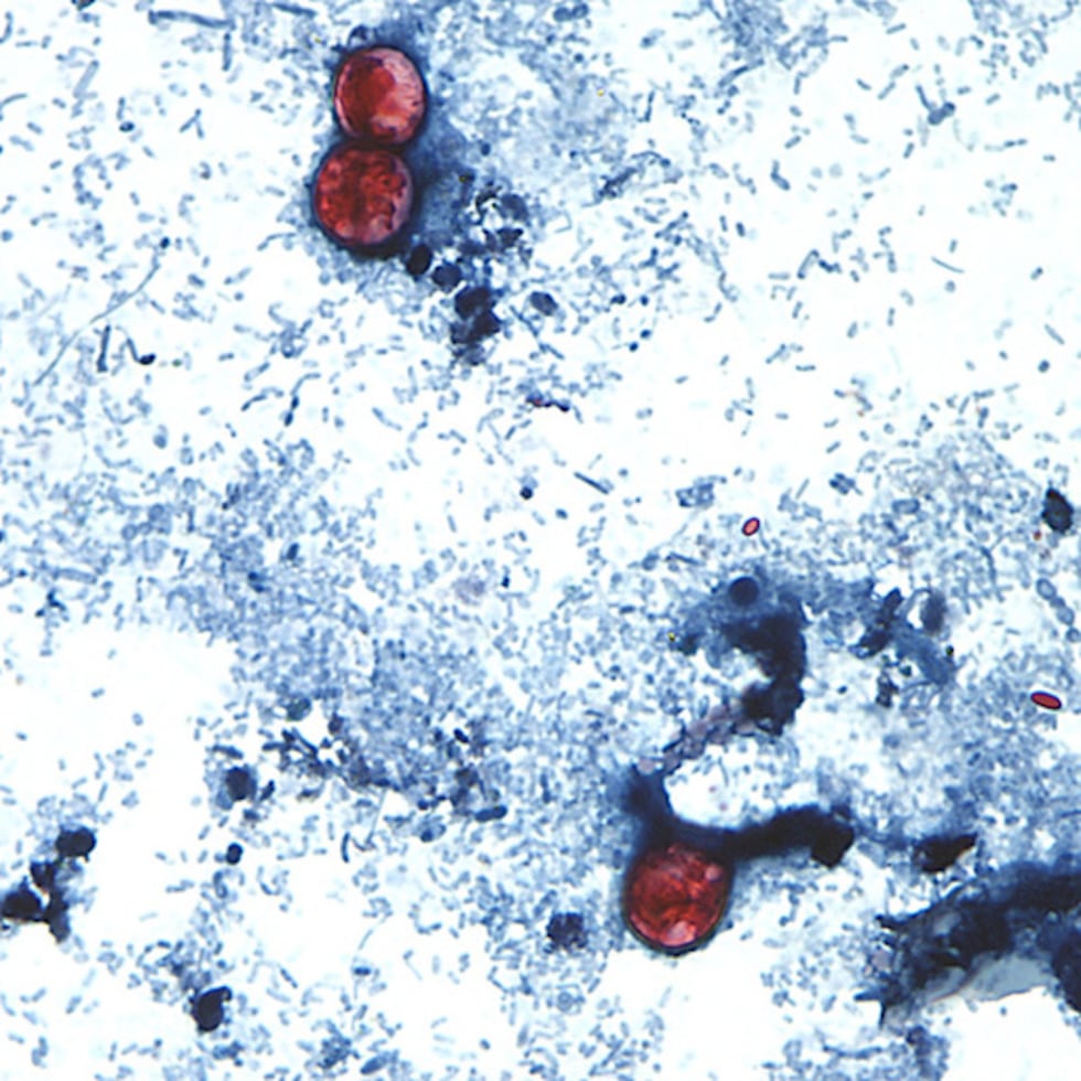 Esta fotografía, tomada a través de un microscopio cedido por los CDC, muestra oocistos de Cyclospora cayetanensis encontrados en una muestra de heces frescas que había sido preparada con una solución de formalina y teñida con safranina.