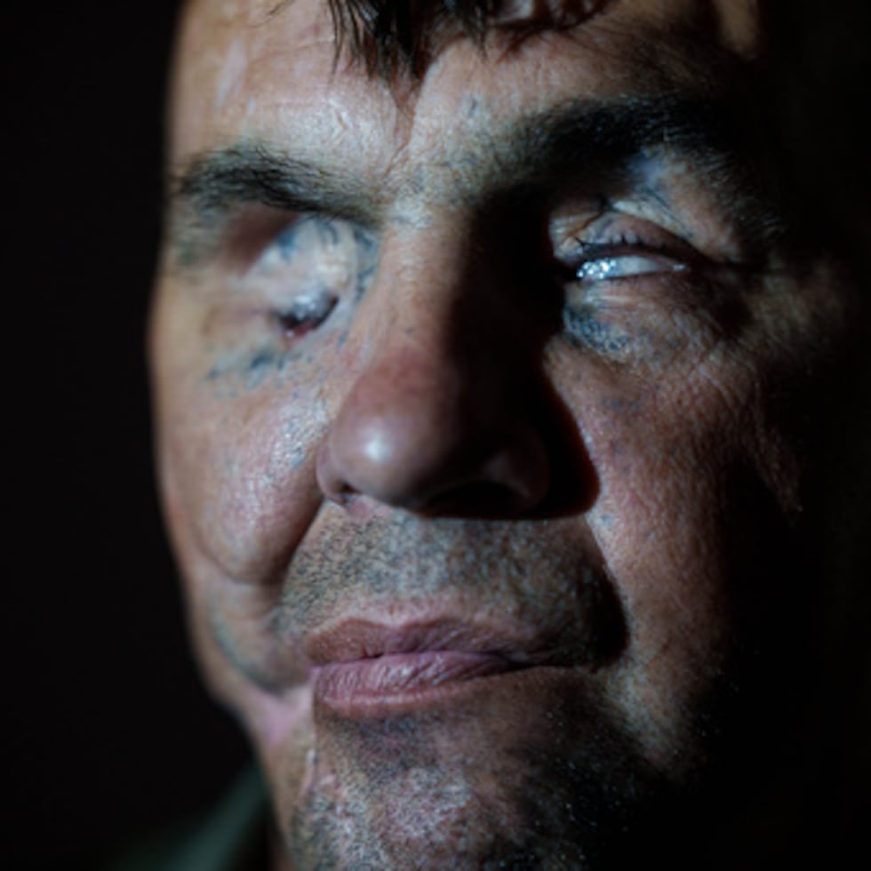 El soldado herido Mykola Kasiuk posa para una foto antes de someterse a una intervención quirúrgica en un hospital regional de Kiev (Ucrania), el lunes 28 de septiembre de 2026. (Foto AP/Evgeniy Maloletka)