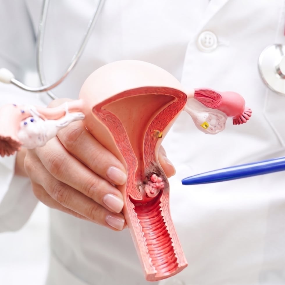 Cerca del 20% de las mujeres en edad recomendada no están al día con las pruebas de cernimiento para el cáncer cervical, lo que limita las oportunidades de prevención y tratamiento oportuno.