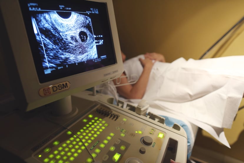 Sonograma de una paciente que se sometió a fertilización in vitro.