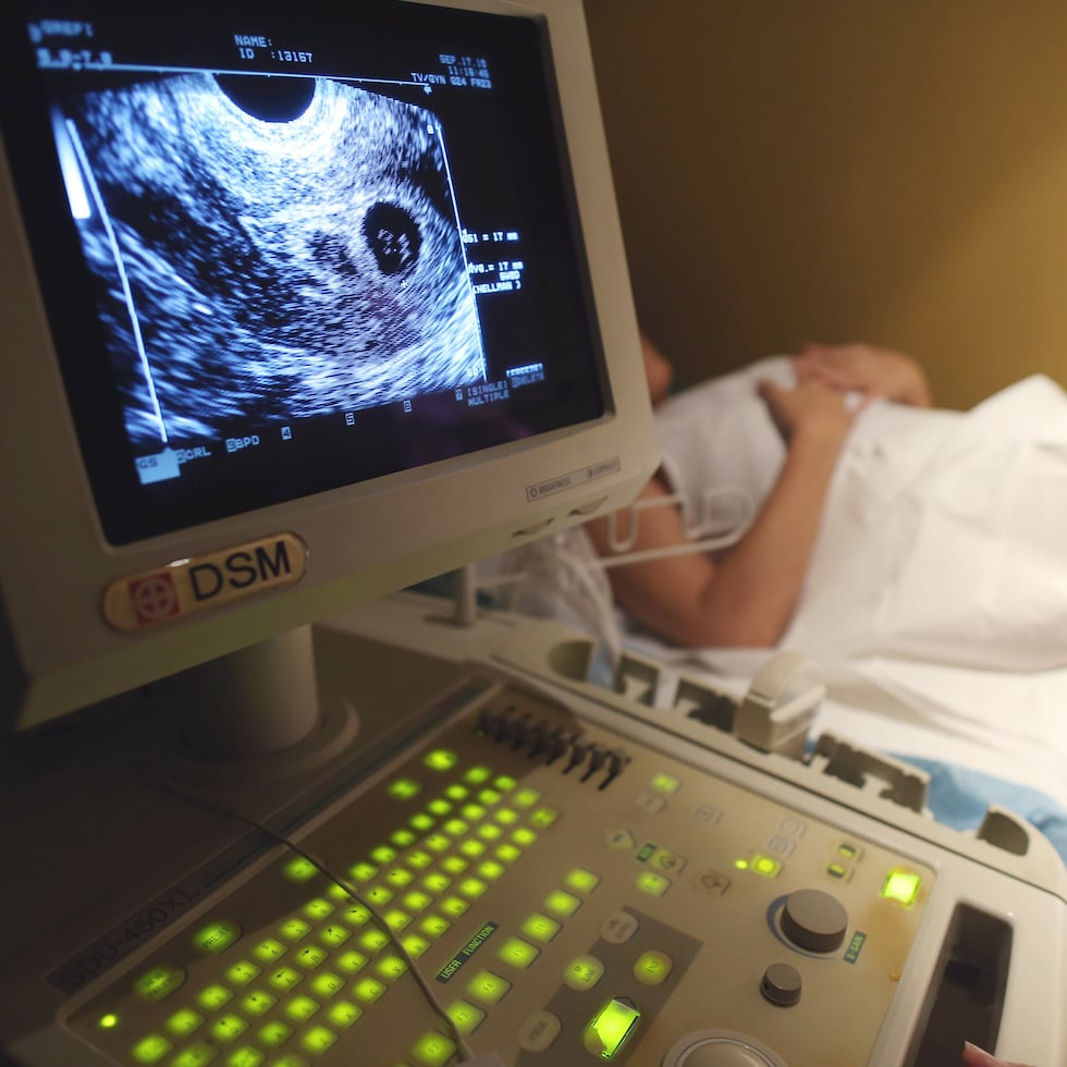 La pareja aseveró en una declaración enviada a los medios locales que desearían quedarse con la bebé.