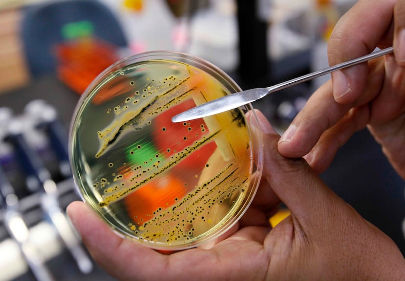 Los productos de esa instalación pudieron estar contaminados con la bacteria. (Archivo/ GFR Media)