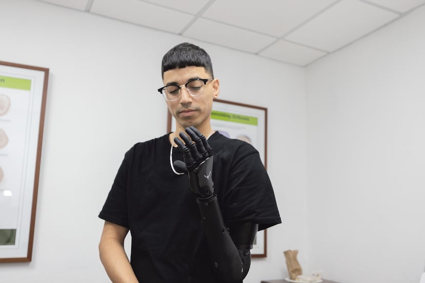 Lesionado Damián Seda Alemán durante la entrega de su prótesis mioeléctrica.