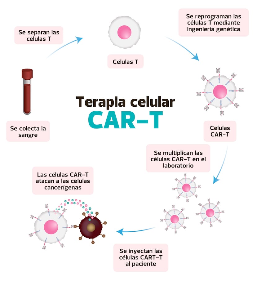 Terapia celular CAR-T