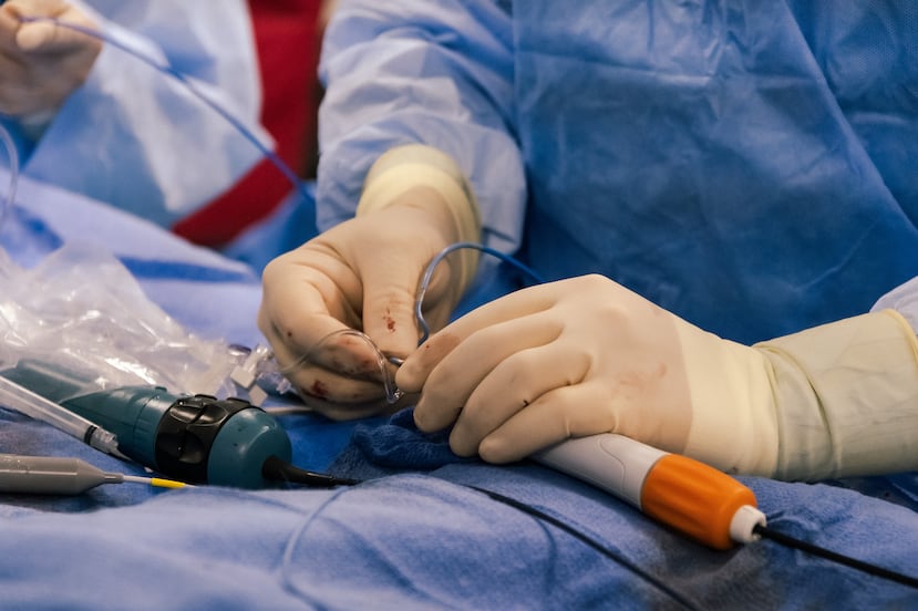 VARIPULSE™ es una opción de ablación por campo pulsado que utiliza energía eléctrica de forma controlada para proteger los tejidos circundantes.