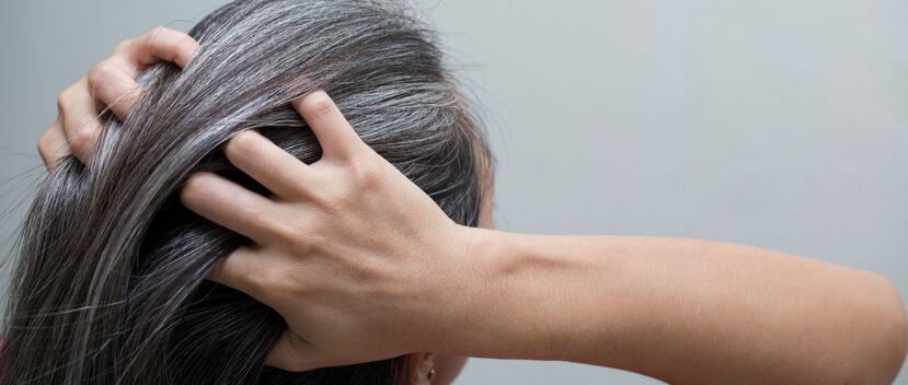 El encanecimiento del pelo en algunos casos sería una señal de alerta para el organismo. (Shutterstock)