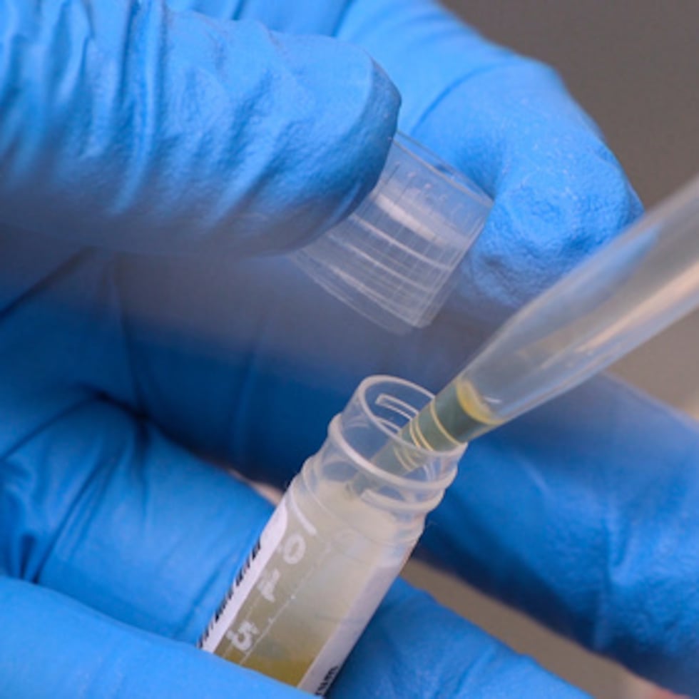 Es probable que los recortes de financiación hayan perturbado la vida de los pacientes de distintas maneras.