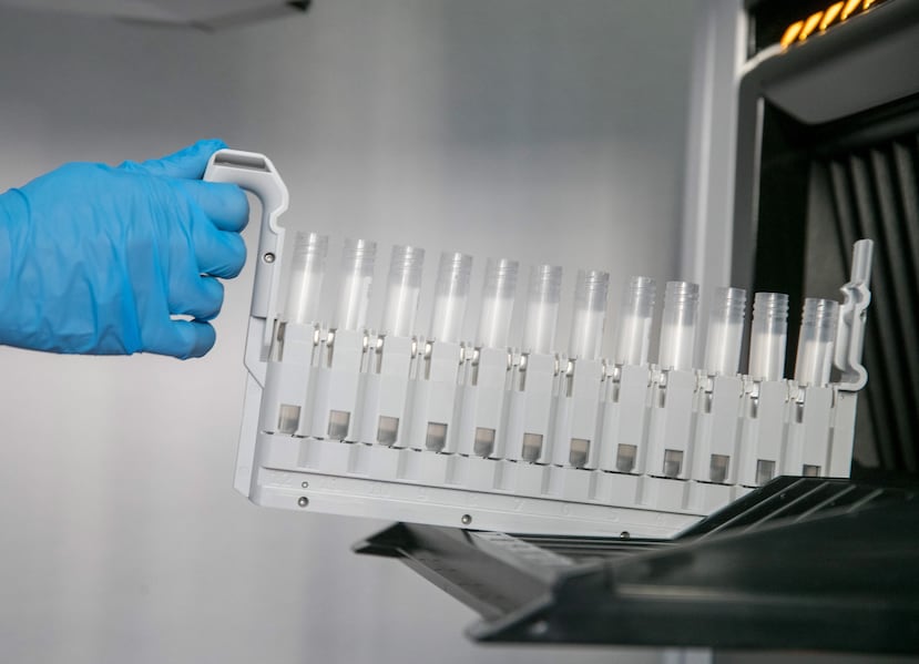 El alzhéimer es un trastorno cerebral progresivo y la forma más común de demencia, que destruye lentamente la memoria, el pensamiento y la capacidad para realizar tareas cotidianas.