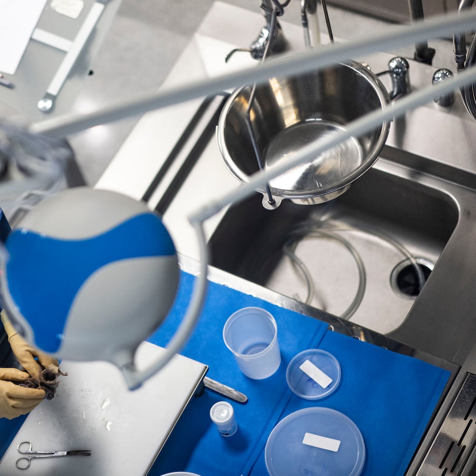 Una autopsia reveló que la víctima, de 80 años, falleció tiempo después de la agresión por complicaciones relacionadas con el golpe que le propinó su hijo.