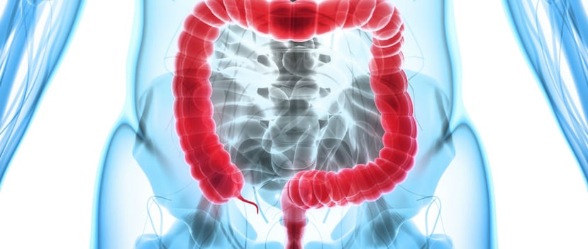 A prevenir el cáncer colorrectal