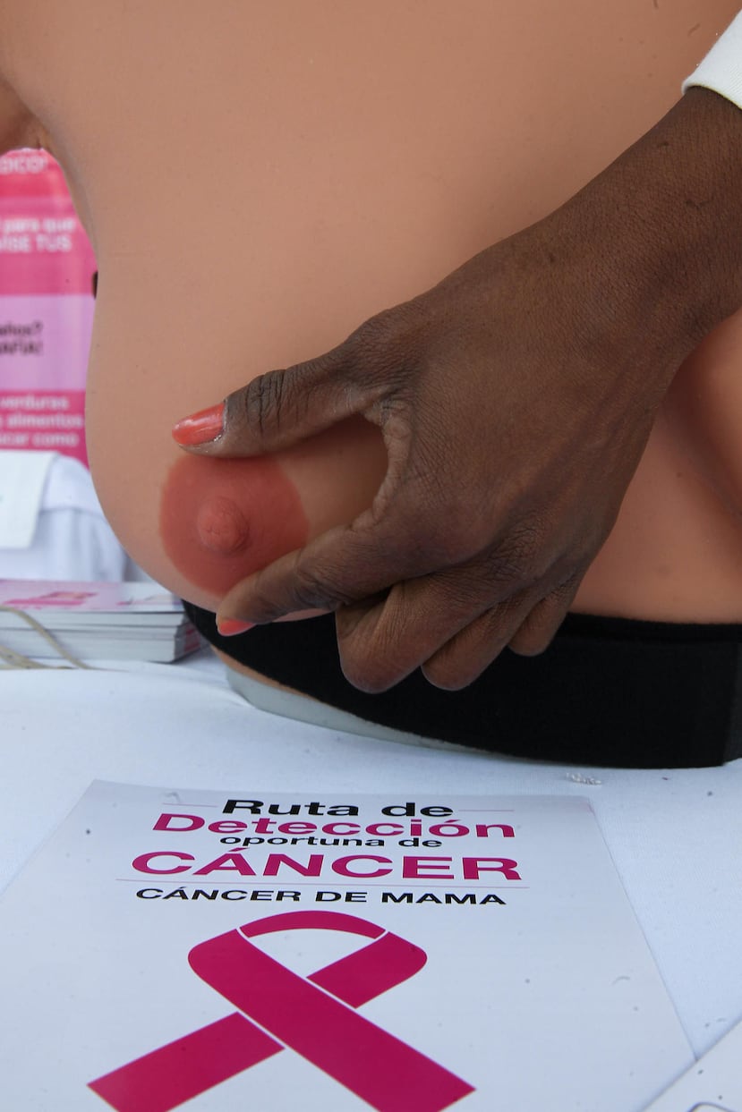 Fotografía de archivo del 4 de febrero de 2017 de una persona explicando cómo realizar una autoexploración mamaria, en Ciudad de México (México). Expertos en el área médica coincidieron en que América Latina enfrenta un reto en la lucha contra el cáncer de mama tras la falta de datos y registros precisos que permitan dimensionar el problema y diseñar políticas efectivas, durante un foro realizado por Diálogos EFE. EFE/ Alex Cruz/ ARCHIVO