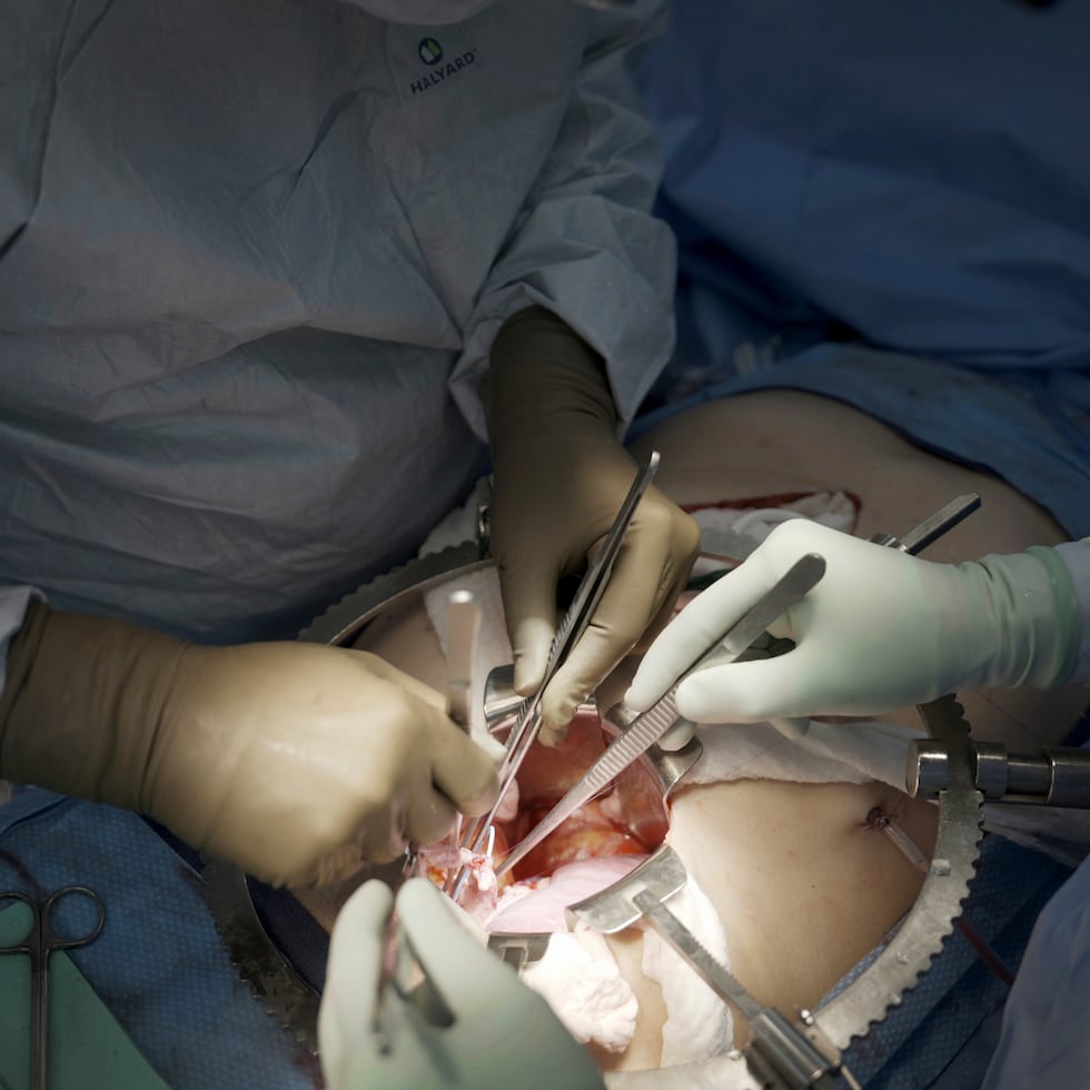 Cirujanos del centro médico Langone Health de la Universidad de Nueva York se preparan para trasplantar un riñón de cerdo a un hombre con muerte cerebral, el 14 de julio de 2023, en Nueva York.