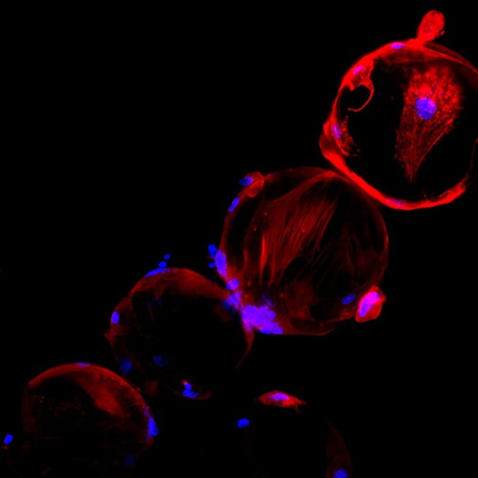 Imagen del estudio de células madre mesenquimales en microgravedad en la Estación Espacial Internacional. El color rojo marca el cuerpo de las células y el azul, el núcleo.