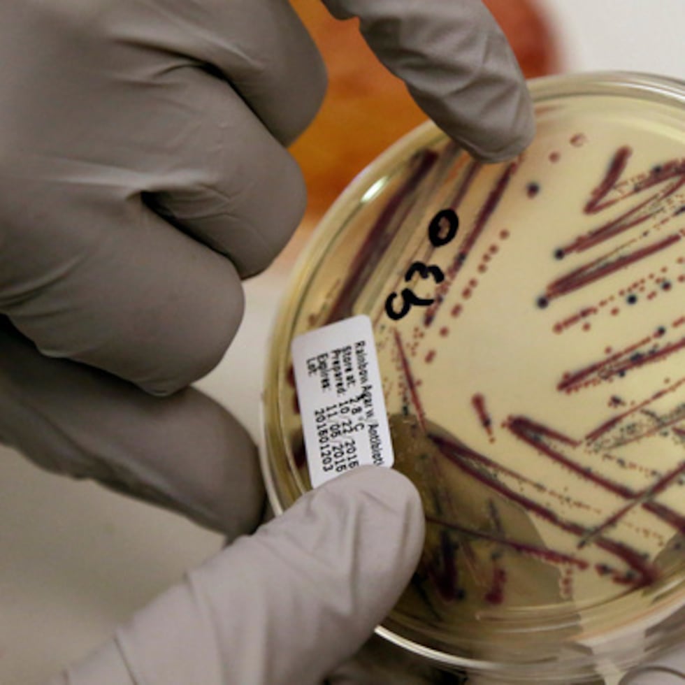 Un microbiólogo señala un cultivo aislado de E. coli en una placa de agar en el Departamento de Salud del Estado de Washington, el 3 de noviembre de 2015.